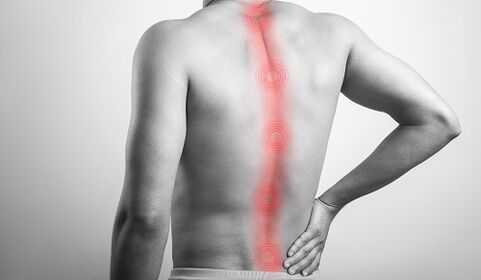 Varias lesións nas costas provocan dor na rexión lumbar