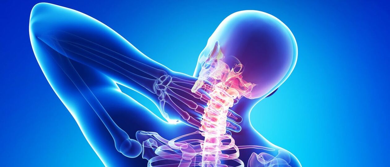 A osteocondrose cervical é un proceso patolóxico na área da columna vertebral
