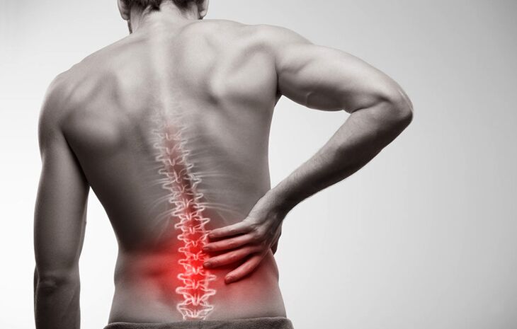 Dor lumbar debido á osteocondrose